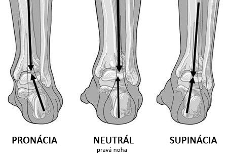 pronated-supinated-diagramoffeet.jpg.dcc6ac18473038e52d333d74e13e53c9.jpg